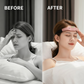 🔥Christmas Limited-Time Offer: 50% OFF!!!🔥Smart Head Massager For Deep Sleep
